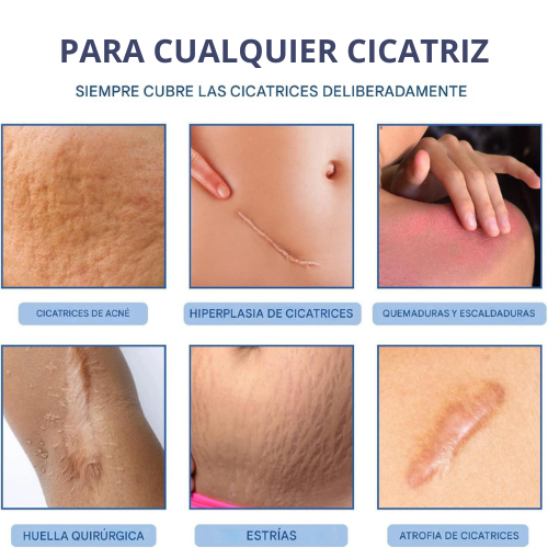 Elimina todo tipo de Cicatrices y Recupera una Piel Impecable en Solo 8 Semanas